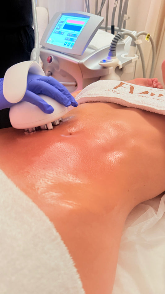 Venus Legacy + Lymphatic Drainage (1 or 2 Areas)